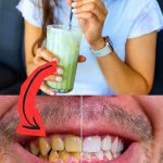 does matcha stain teeth