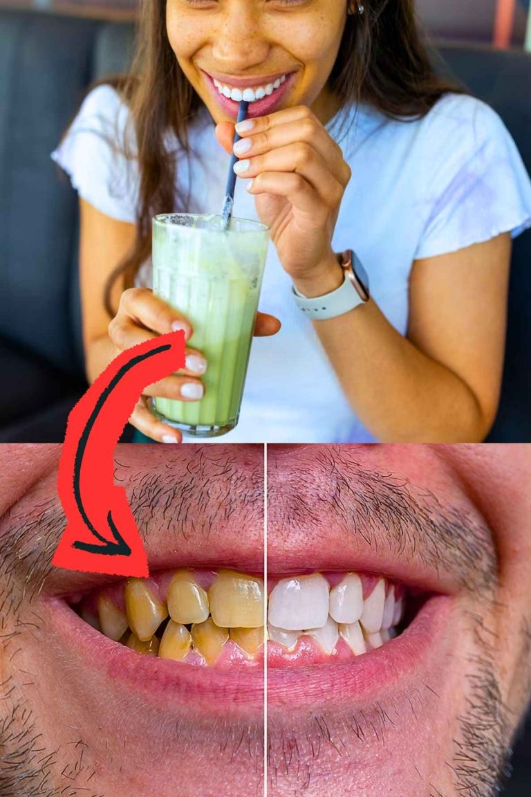 does matcha stain teeth