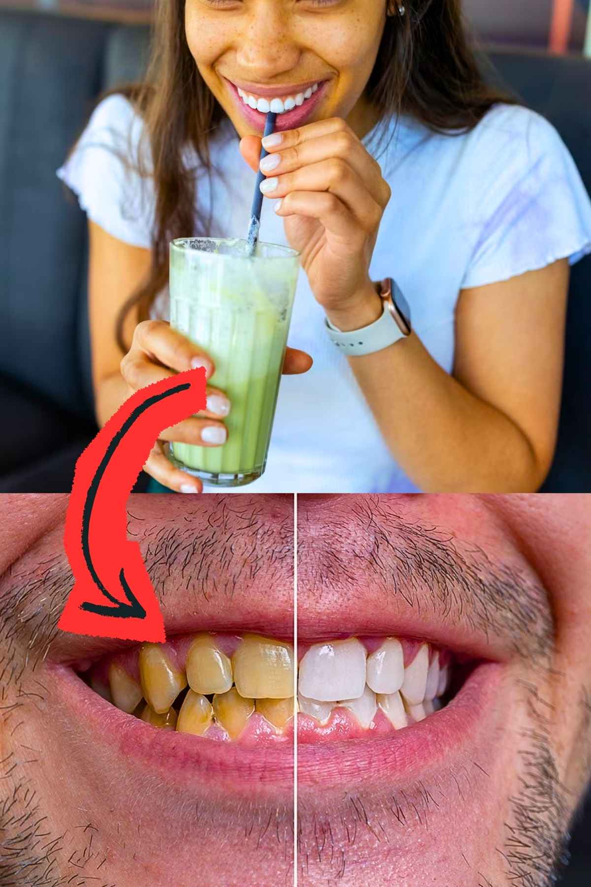 does matcha stain teeth